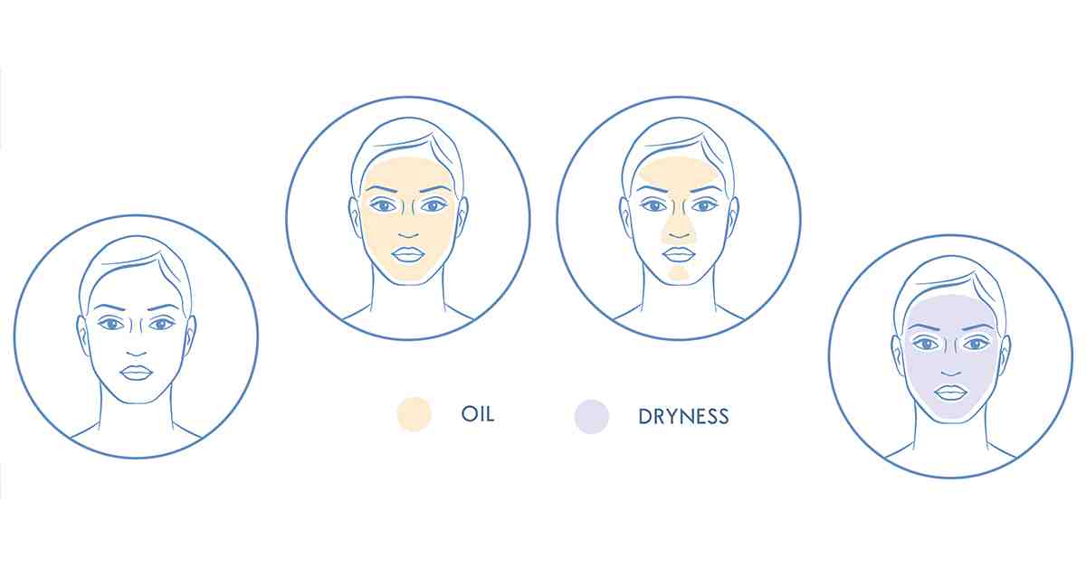 Skin Types